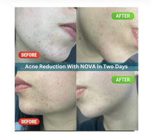 Load image into Gallery viewer, CELESTIAL DUO NOVA REJUVENATION STARTER KIT / RENEW + REVITALIZE